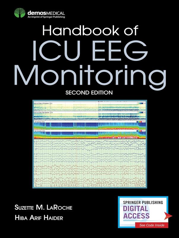 81wwboffMHL._SL1500_1.jpg Handbook of ICU EEG Monitoring – 2nd Edition - Image 1